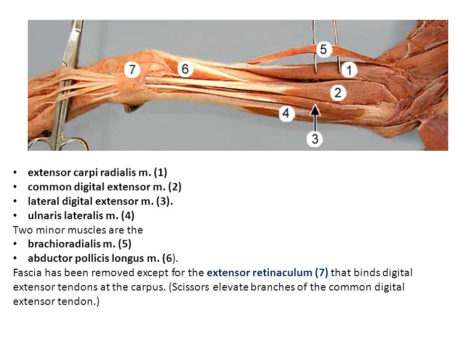 ECR rupture